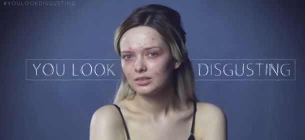 Em Ford, la beauty blogger mostra il viso senza trucco e il web la insulta: "Sei disgustosa" [VIDEO]