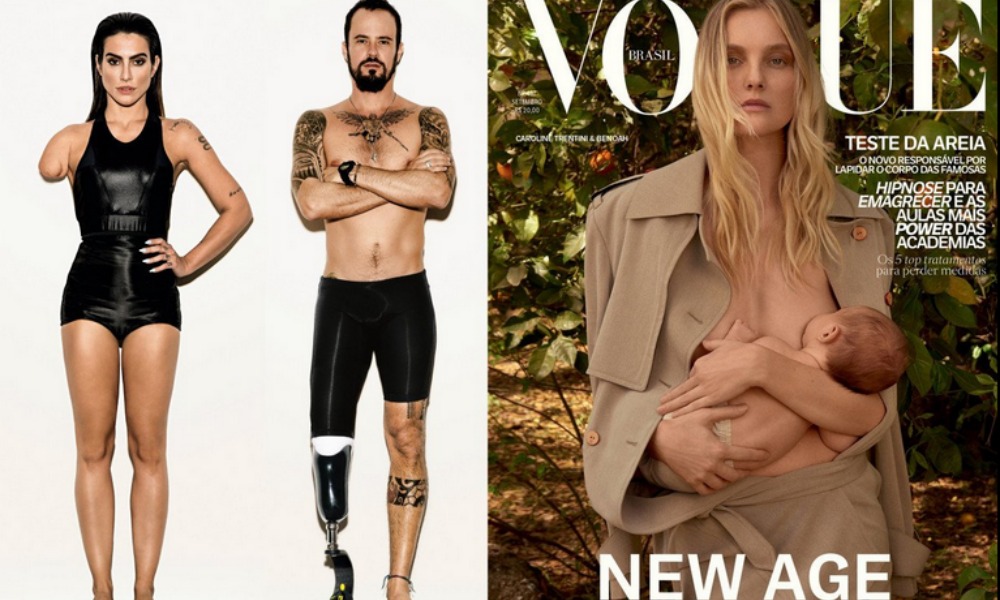 Paralimpiadi: Vogue Brasile photoshoppa i modelli e li rende disabili, è polemica