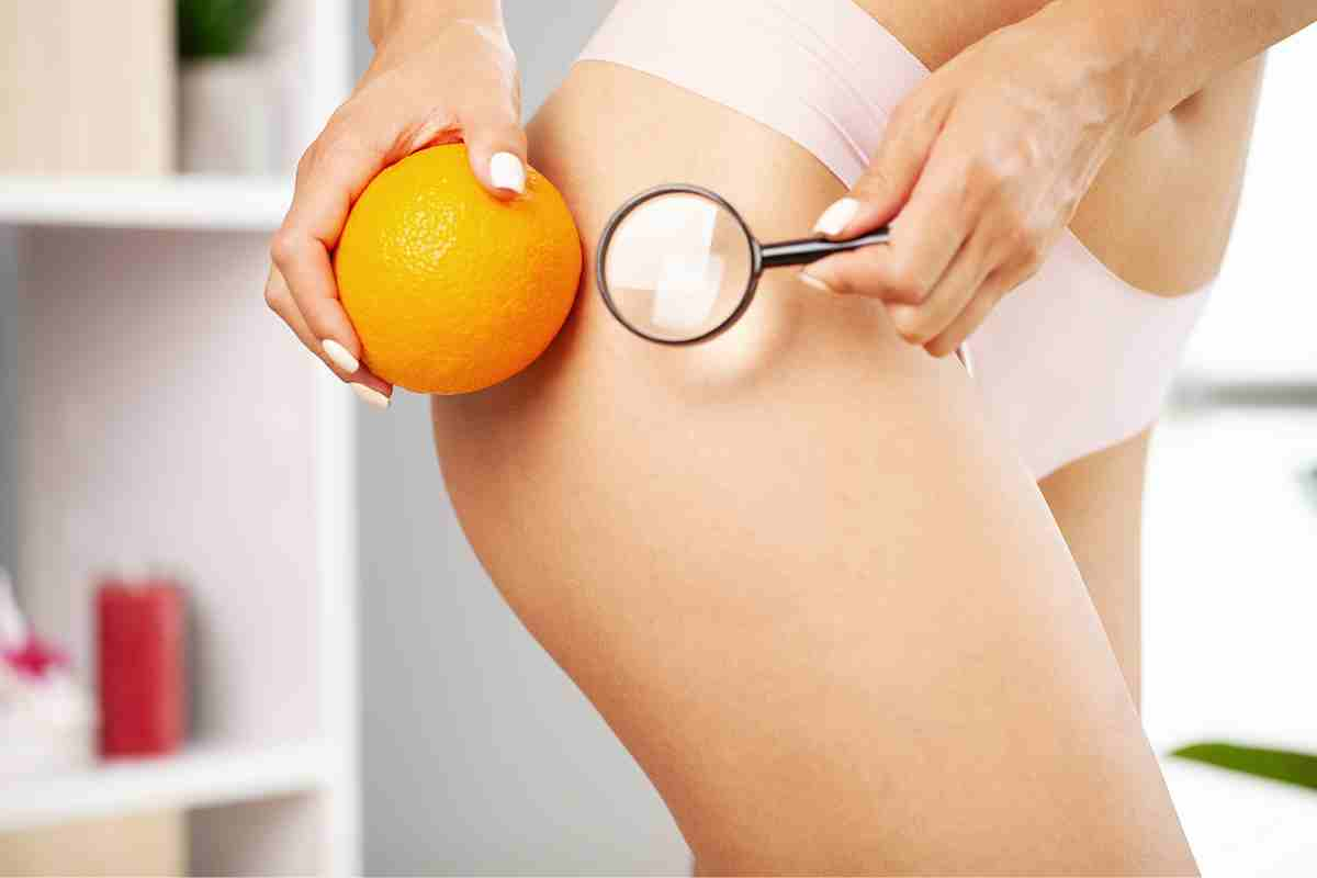 Cellulite, ecco tre esercizi da fare per combatterla