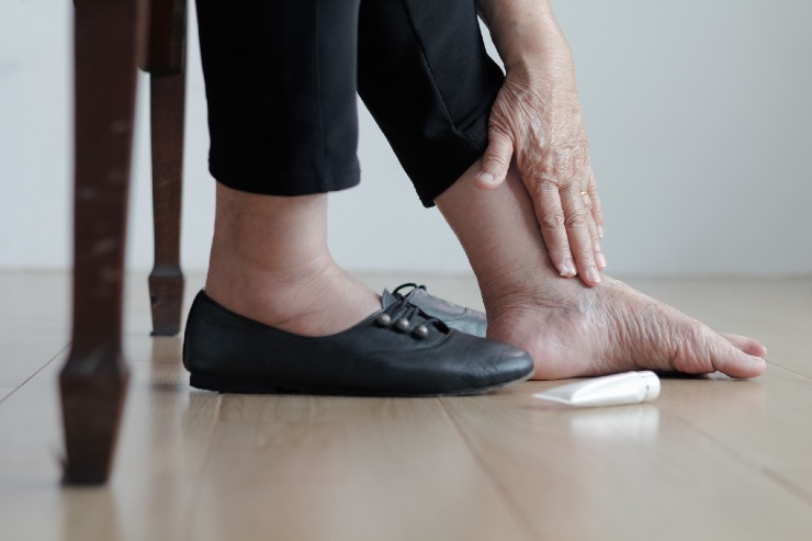 Cause e rimedi naturali per i piedi e le caviglie gonfie