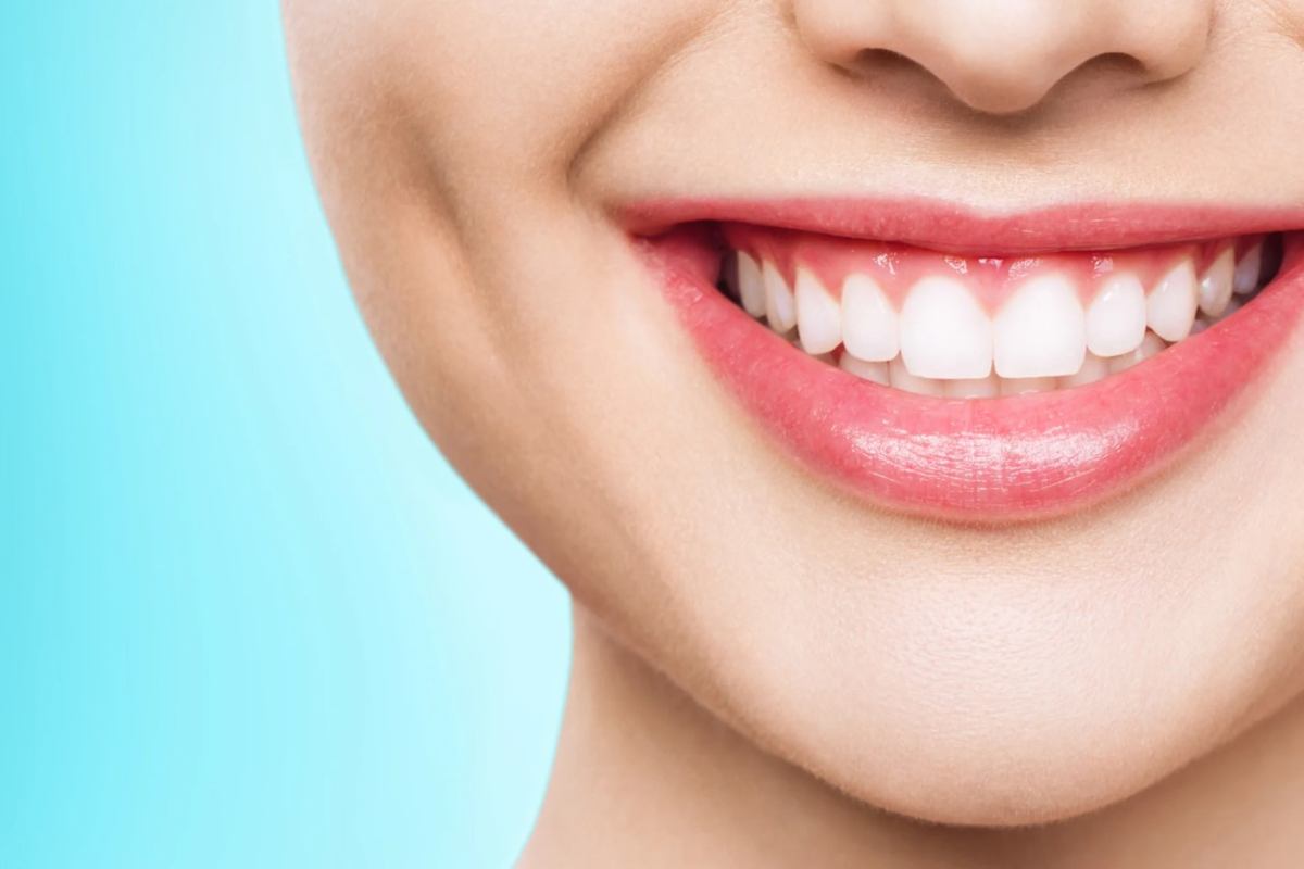 come avere denti bianchi con rimedi naturali